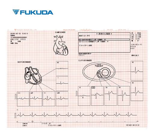 may dien tim FX8322.jpg